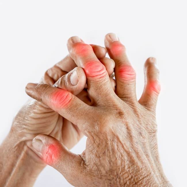 reumatología. Medical Center Tecamac